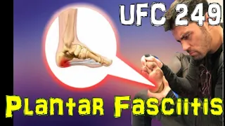 UFC 249: Will Dominick Cruz's Plantar Fasciitis be a Factor?