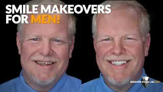 Smile Makeovers for Men! Incredibil™ Dental Veneers by Brighter Image Lab!