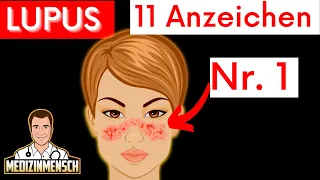 Autoimmunkrankheit Lupus erkennen (SLE, Rheumatologe erklärt Symptome)