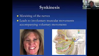 Lecture: Facial Palsy: Oculoplastic Management
