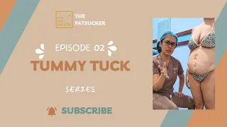 The Fat Sucker - Dr. Claudine Roura - Tummy tuck series Episode 2