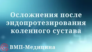 Осложнения после эндопротезирования коленного сустава | ВМП-Медицина