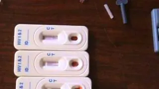 Showing a Positive instant home HIV test