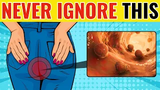 Critical Colon Cancer Symptoms You Should NEVER Ignore! | #coloncancer