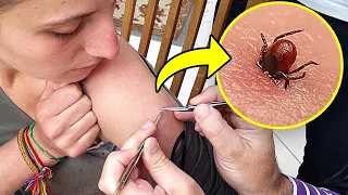 इन 5 जहरीले कीड़े से हमेशा बचकर रहें Most Painful Insect Stings In The World