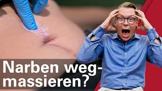 Wenn du deine Narbe so massierst, wird sie quasi unsichtbar! (Narbenmassage Anleitung)