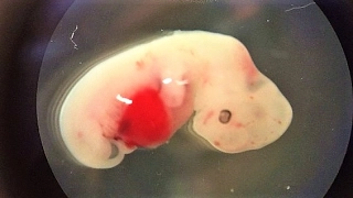 Scientists Create Human Pig Hybrid Embryo !