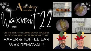 PAPER & TOFFEE EARWAX REMOVAL!! - EP707