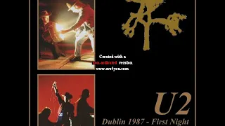 1987 06 27   Dublin, Ireland   Croke Park