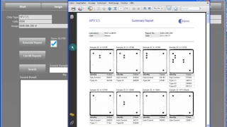 SlideReader Tutorial