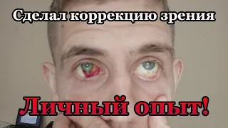 Сделал лазерную коррекцию зрения! Как это было, как Я восстановил зрение! Путь достойного человека