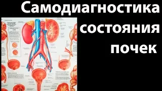 Самодиагностика состояния почек (№6 из цикла "Самодиагностика")