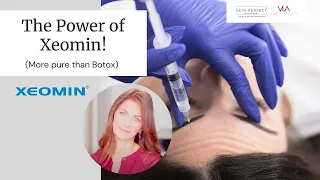 Xeomin Testimony – Best Alternative To Botox @ Skin Perfect Brothers