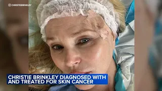 Actress Christie Brinkley diagnosed with cancer