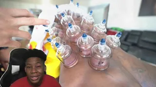 CashNasty The WORST PAIN EVER From Basketball & Lifting Weights! Cupping Therapy Reaction