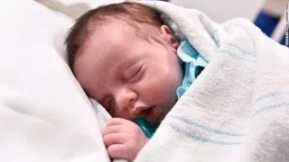 Baby 'born twice' after miracle surgery