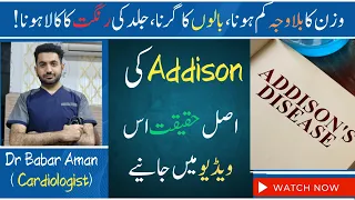 What is Addison Disease? | Wazan ka Bilawjha km hona , Balon ka Girna , Jild ki Rangat ka Kala hona!