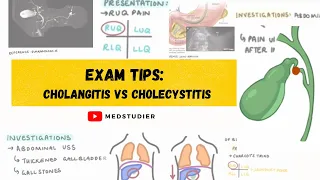 Exam Strategy: Cholecystitis vs Cholangitis | MedStudier