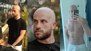 Tinder Experiment: Do Bald Guys Get Matches?
