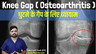 Knee gap exercises in hindi - exercise for knee pain | knee osteoarthritis pain | Dr. Sunil Tank