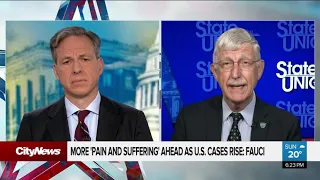 More ‘pain and suffering’ ahead as U.S. cases rise: Fauci