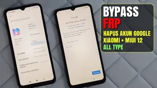 [Terkunci Akun Google] Bypass Frp Unlock Google Account Hp Xiaomi Yang Sudah Update MIUI 12 Terbaru