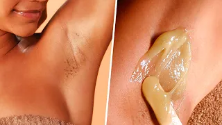 How to Get Rid of Dark Armpits | SATISFYING Ingrown Hair Removal