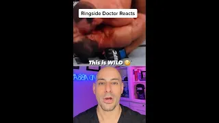 Luke Rockhold PURPOSELY SMEARS🩸🩸on Paulo Costa Face - Ringside Doctor Reacts #shorts