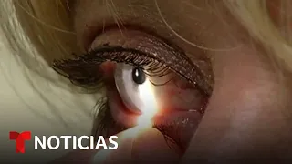 Emiten una nueva alerta por estas gotas para los ojos | Noticias Telemundo