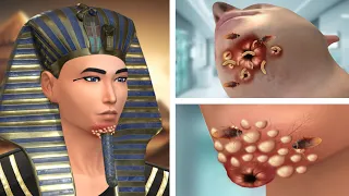 ASMR Treats ulcers & Parasitic insects under the chin | Deep Cleaning Animation