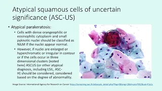 Cervical Cytology #2