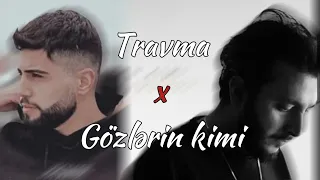 "Travma" mix "Gözlərin kimi" [ İlkin Abbasov, Lila, Jeyhun Samedov ]