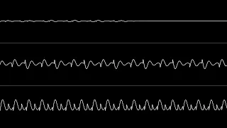 Jammer - “Under My Skin” (C64) [Oscilloscope View]