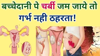 बच्चेदानी में सूजन या चर्बी के कारण गर्भ नही ठहरता/ bachedani me sujan ya charbi kaise hota hai