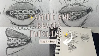 How To Draw Smile Braces🦷 || Step by Step (Beginner Friendly)