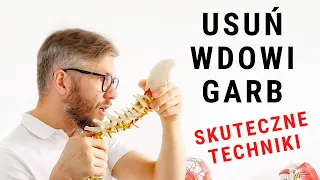 WDOWI GARB - jak się go pozbyć - SKUTECZNE TECHNIKI - dr n. med. Marcin Wytrążek