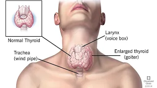 SPOTTING THYROID PROBLEMS: YOU AND DEBORAH NORVILLE?