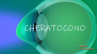 CHERATOCONO: grazie alla innovativa tecnologia "Teranostica" trattamenti personalizzati e definitivi