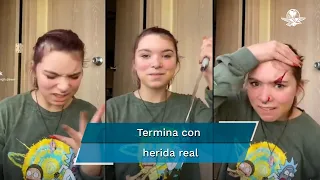 Por hacer reto de TikTok con cuchillo ¡termina lesionada!