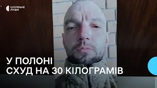 Звільнений з полону волинянин Анатолій Холевінський чекає на операцію