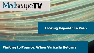 Looking Beyond the Rash | Waiting to Pounce: When Varicella Returns | MedscapeTV