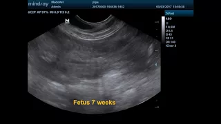 Ultrasound canine fetus development
