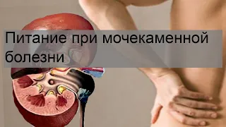 Питание при мочекаменной болезни