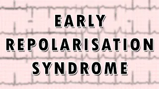 Early Repolarization Syndrome