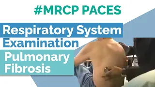 Pulmonary Fibrosis - Cases for PACES - MRCP PACES Station 1