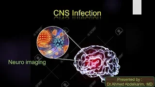 8-cerebral infection