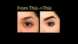 How to Cover Dark circles with Makeup | Chandrika