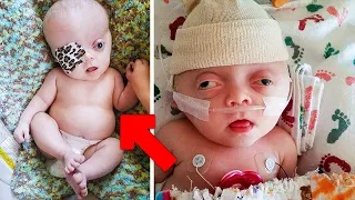 The doctors remove her skull and a true miracle happens