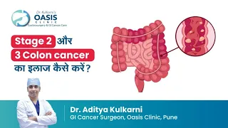 Stage 2 और 3 colon cancer का इलाज कैसे करें? | Dr Aditya Kulkarni | Oasis Clinic