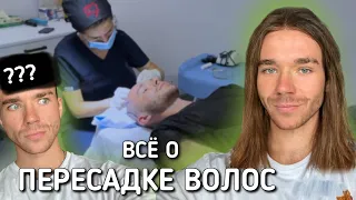 Моя ПЕРЕСАДКА ВОЛОС. Больно? Когда вырастут?